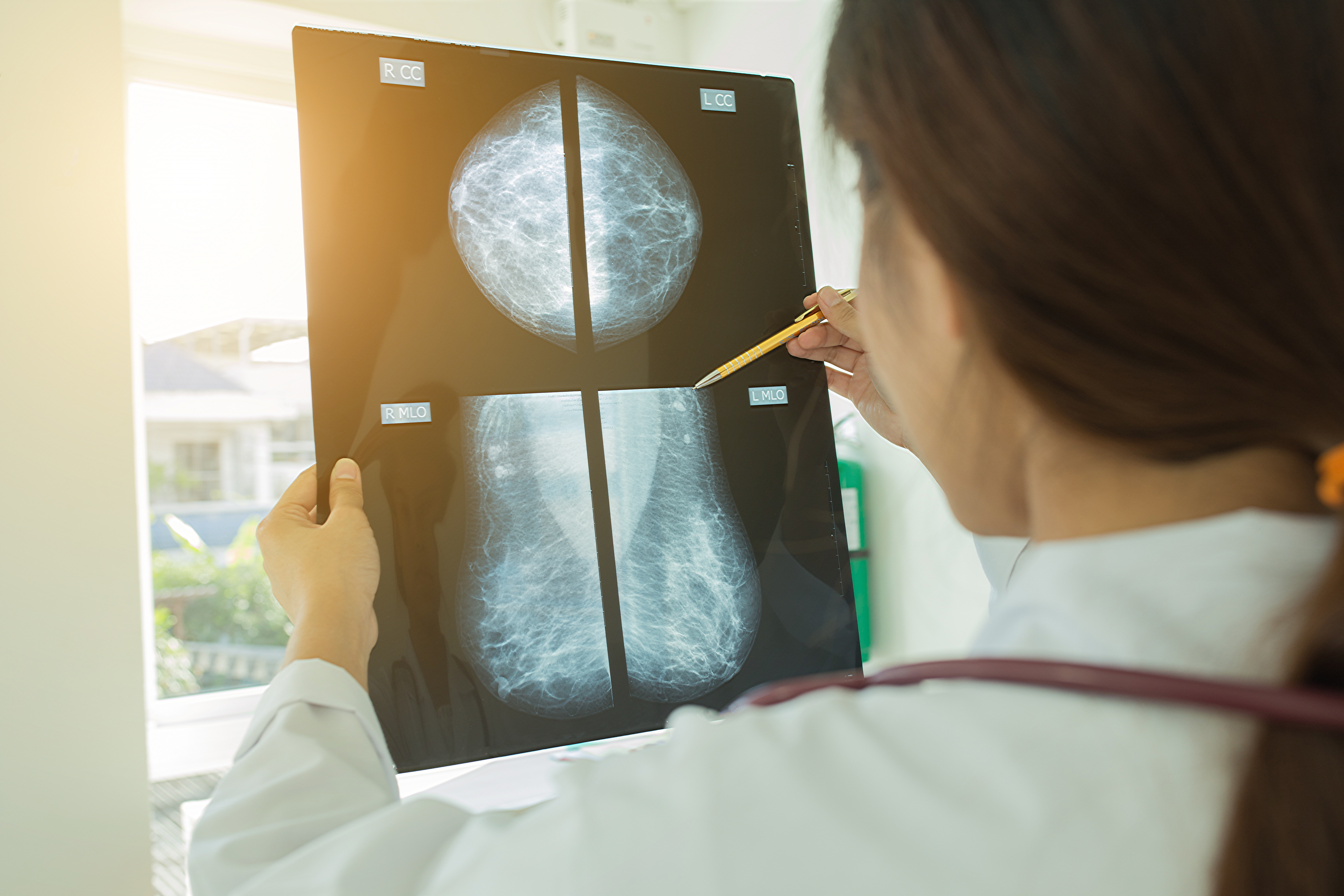 Benefits of a mammogram
