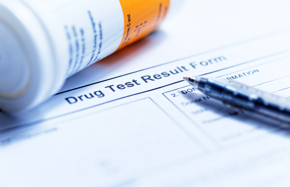 Is a Drug Test Part of a Dot Physical?