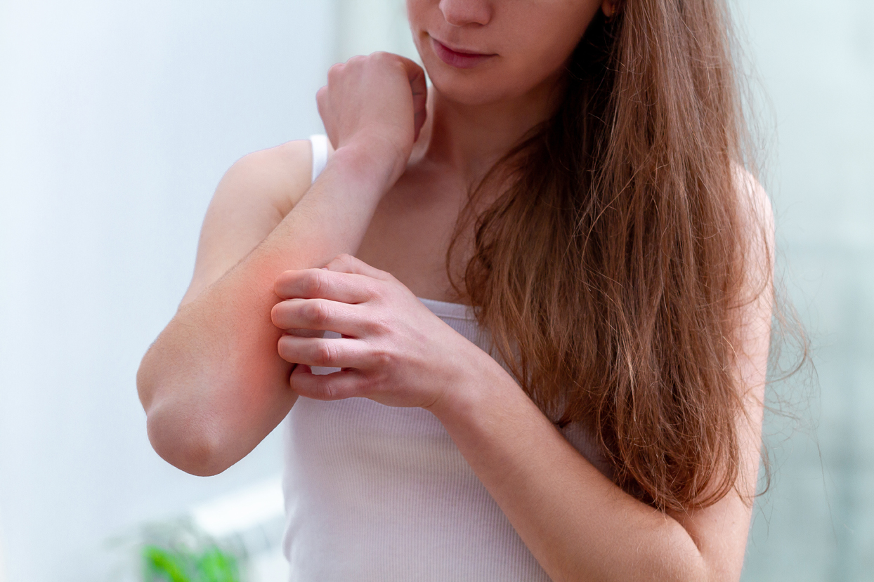 Closeup of a young woman scratching an itch on her forearm.