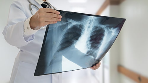 a medical provider looking at an x-ray