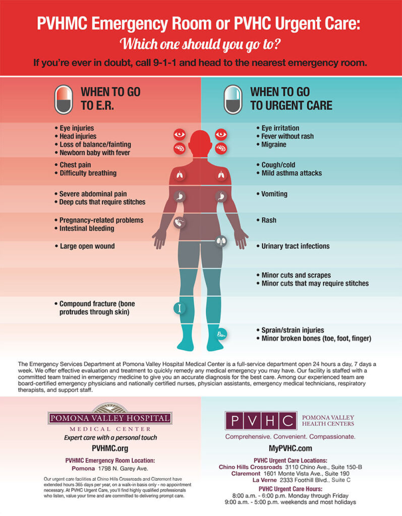 Urgent Care Pomona Valley Health Centers   Infographic 2018 Updated 797x1024 